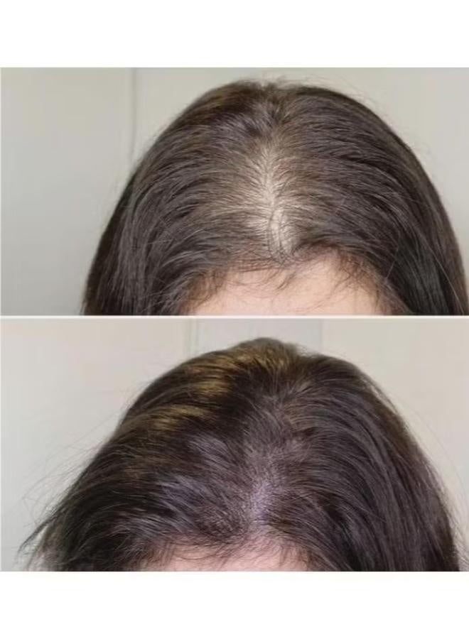 Faster Hair Back Black Garlic Advanced 100 Ml Red - Image 3